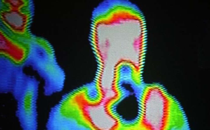 Engineers develop technique that enhances thermal imaging and infrared thermography for police, medical and military use