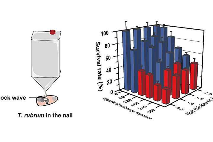 New plasma jet technology effectively treats fungal nail infections