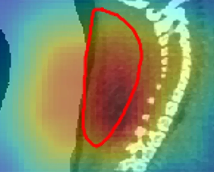 Radioactive beams give a real-time view of cancer treatment in mice