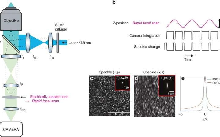 Fast super-resolved microscopy enables structured illumination and extended depth detection