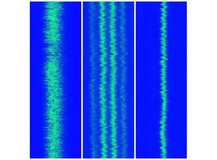 Neat, precise and brighter than ever: New technologies improve temporal coherence of XFEL pulses